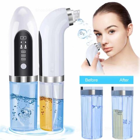 Electric blackhead cleaner with large suction and small bubbles